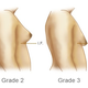 Illustration for article titled Gyno Totally free Body - An important Quality!em/em